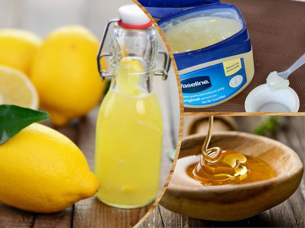 علاج اسمرار حول الفم 3