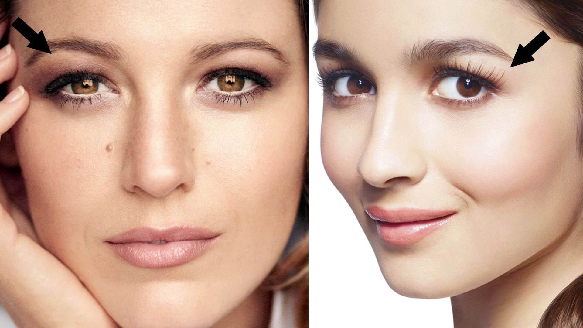 العيون ذات الجفون المغطاه