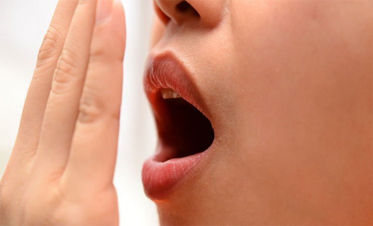 التخلص من رائحة الفم الكريهة