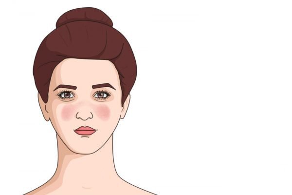 اعرفي وشك ممكن يقولك ايه عن صحتك 2