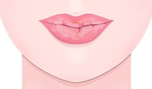 اعرفي وشك ممكن يقولك ايه عن صحتك 5