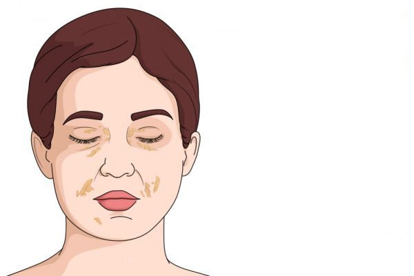 اعرفي وشك ممكن يقولك ايه عن صحتك 9