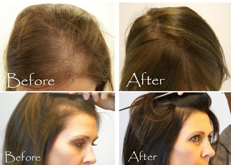 وصفة سحرية لعلاج الشعر الخفيف وفراغات الشعر