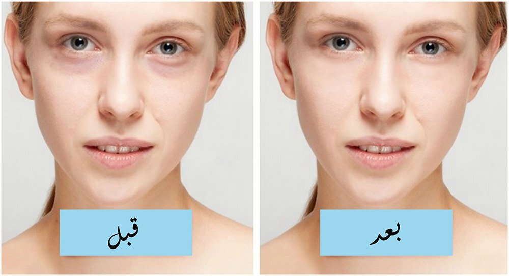 وصفات للبشرة والشعر من القهوة 3