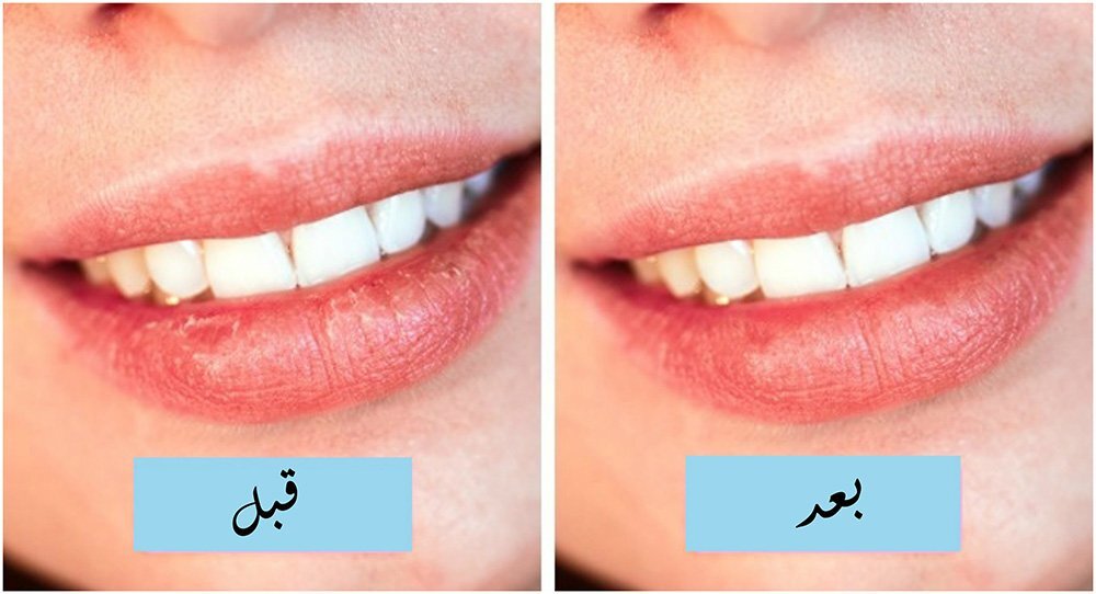 وصفات للبشرة والشعر من القهوة 4