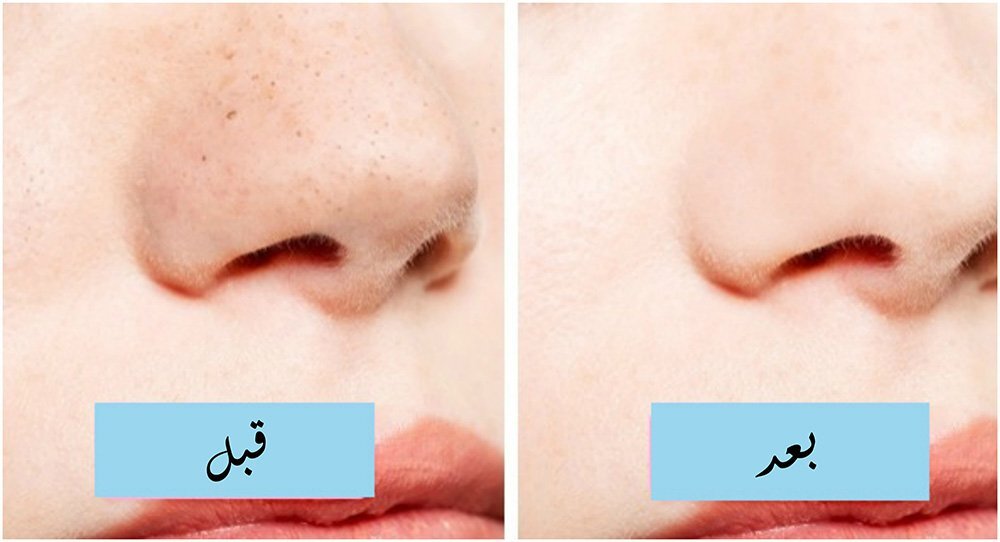 وصفات للبشرة والشعر من القهوة 5