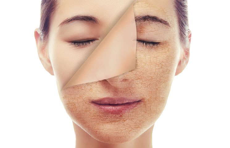 ازاي تكافحي التعب وتحسني بشرتك في الشتا 7