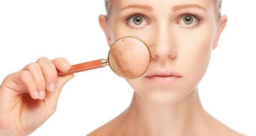 استخدامات الجنزبيل الجمالية 4