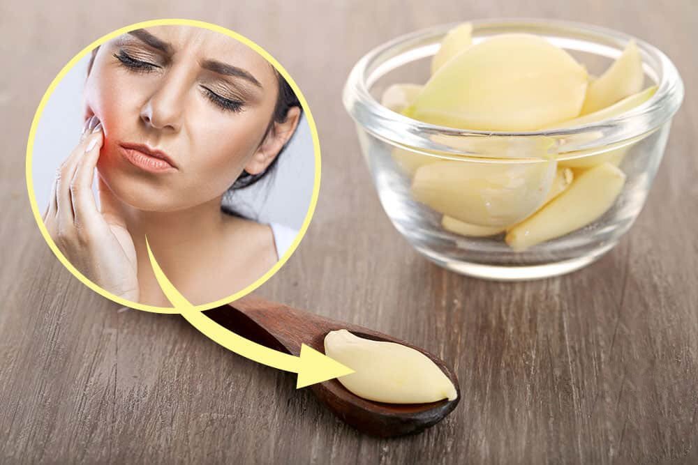 علاجات طبيعية لألم الاسنان 5