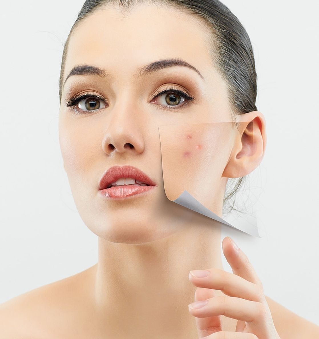 مضمضة الزيت لعلاج حب الشباب 2