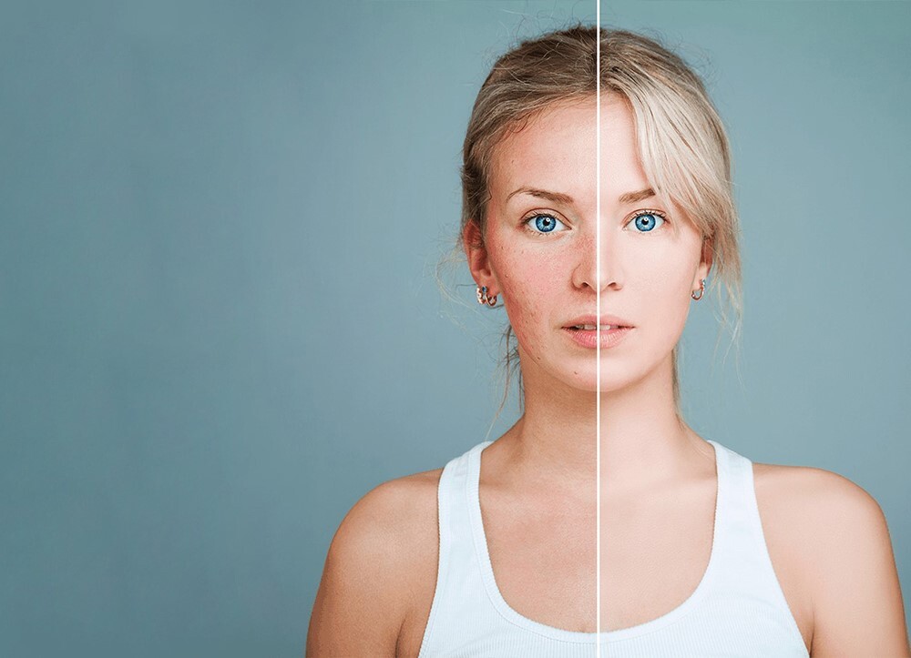 10 حاجات هتحصل لبشرتك وجسمك لما تتوقفي عن استخدام المكياج