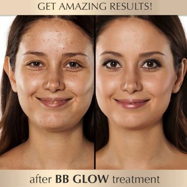 تقنية ال bb glow 2