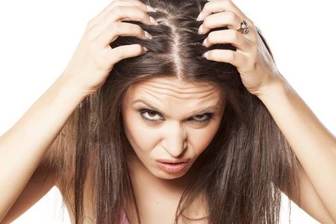 اسباب قشرة الشعر 3