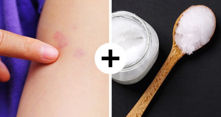 نصايح للاسعافات الاولية السريعة 8