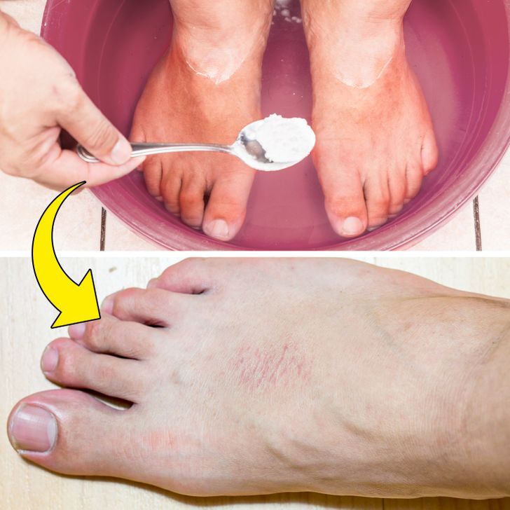 مكونات طبيعية متستخدميهاش بشكل مفرط 8
