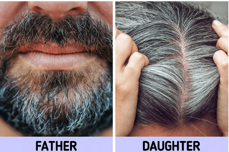 سبب وراثى
