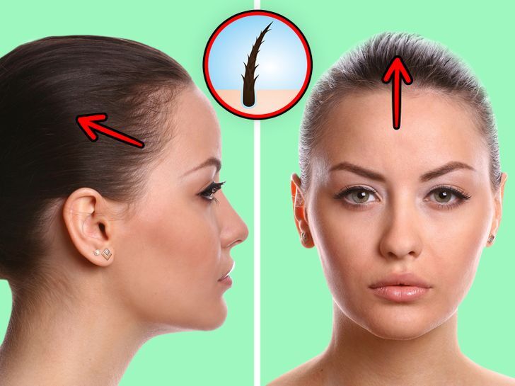اضرار تسريحة ديل الحصان 2