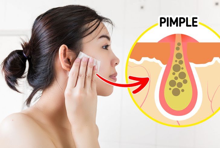 عادات ممكن تدمر بشرتك 5