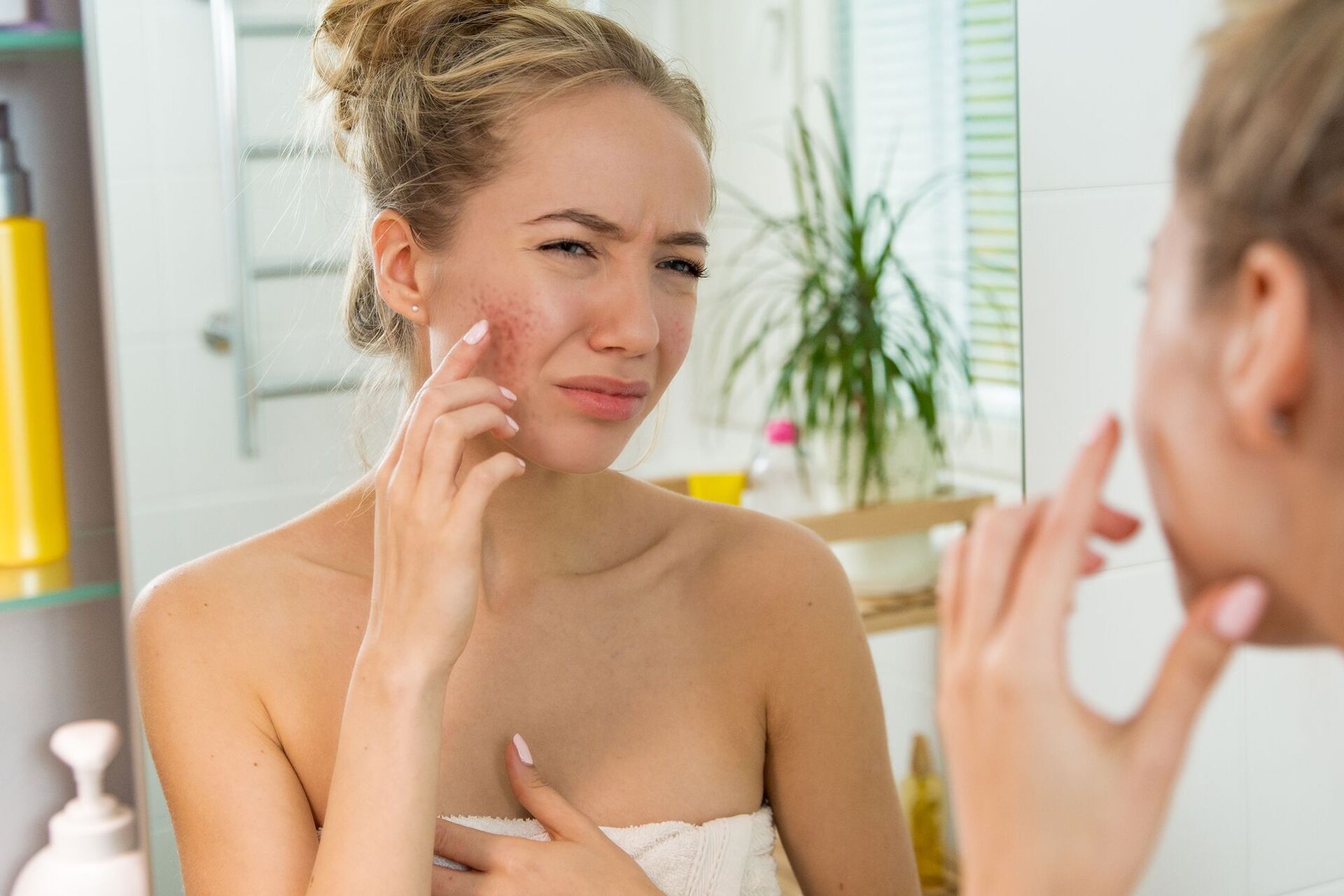 10 نصايح لمنع تهيج واحمرار البشرة