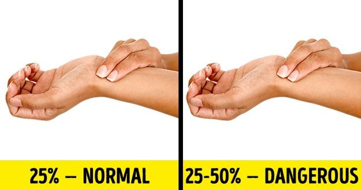 اختبارات سريعة للتأكد من صحتك 2