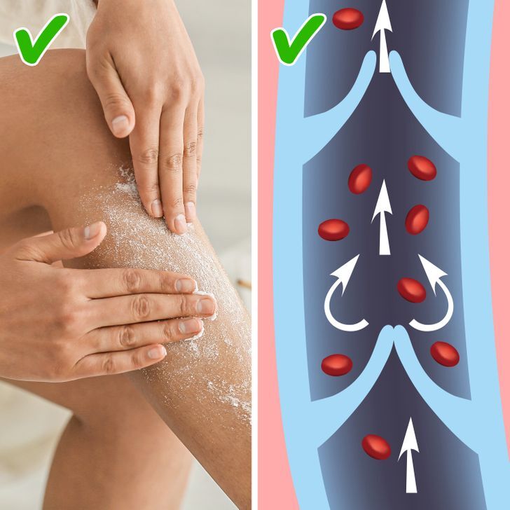 عادات بتسبب دوالي الساقين 2