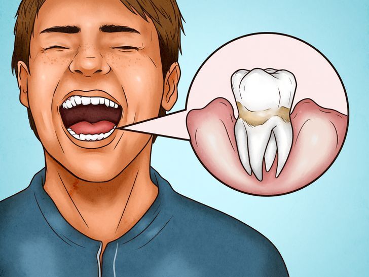 علامات الافراط في استخدام فرشة الاسنان 4
