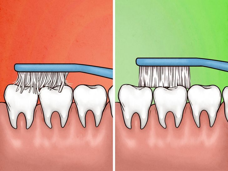 علامات الافراط في استخدام فرشة الاسنان 5