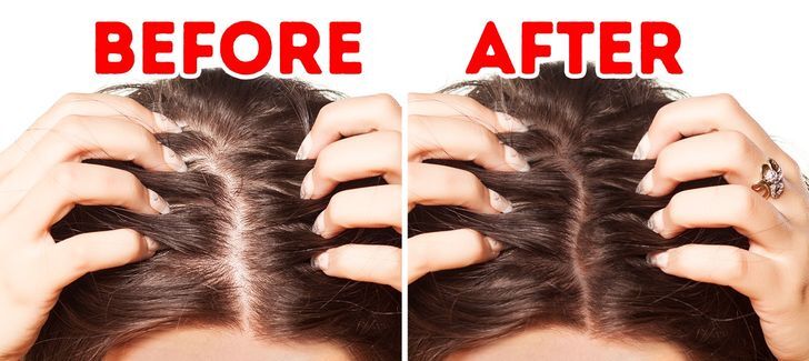 فوايد الجنزبيل للصحة والبشرة والشعر 15