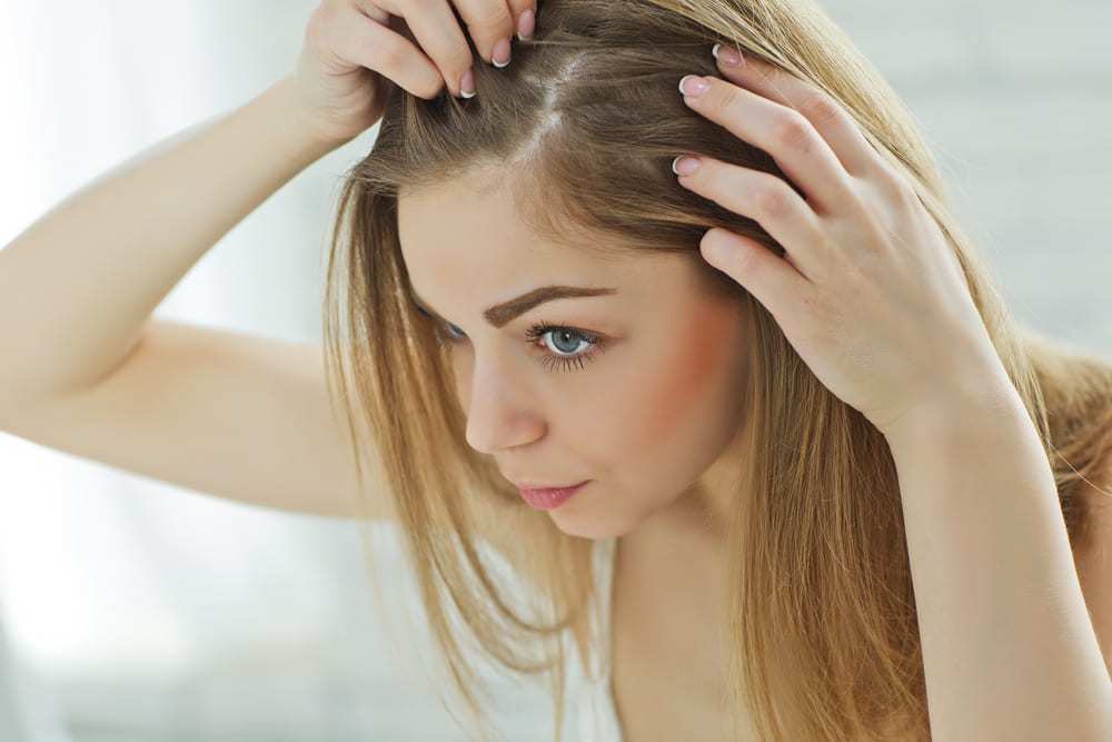 طرق وقف انحسار خط الشعر 3