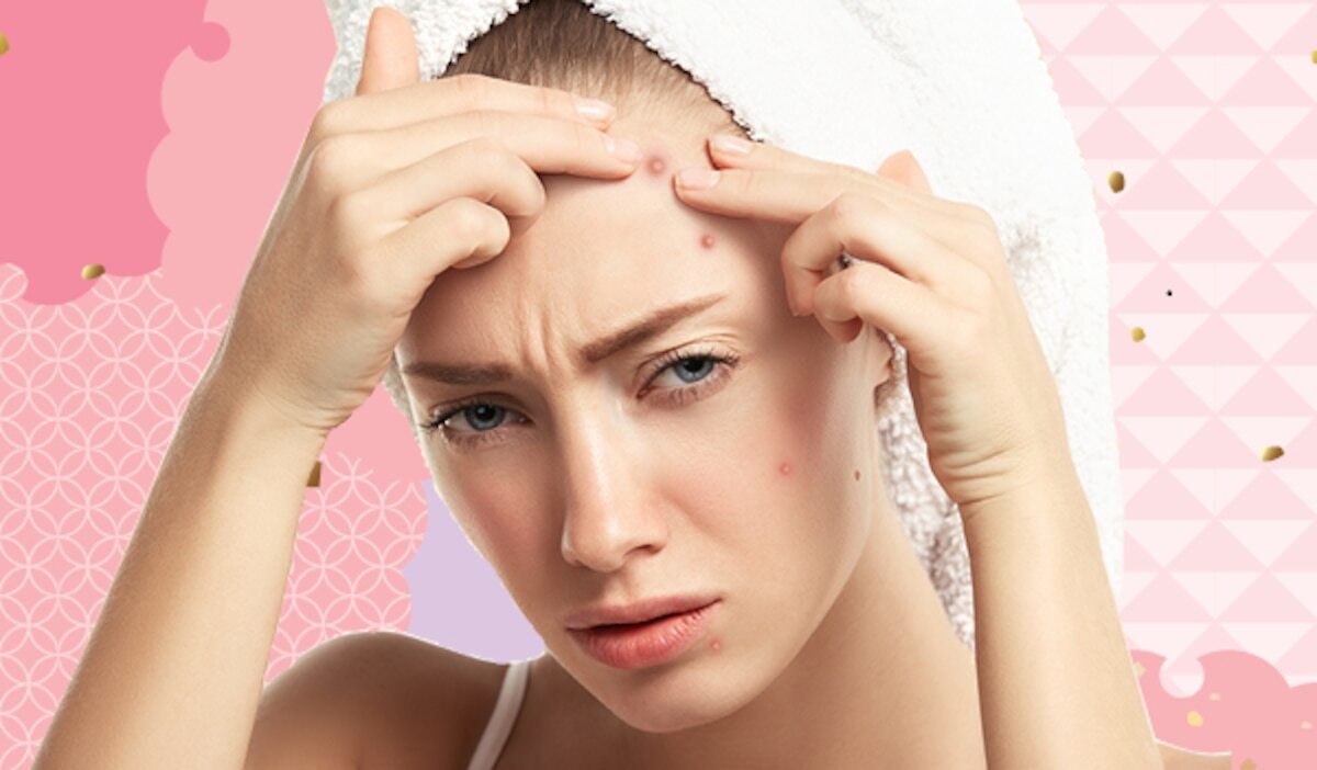 6 طرق طبيعية للتخلص من البثور
