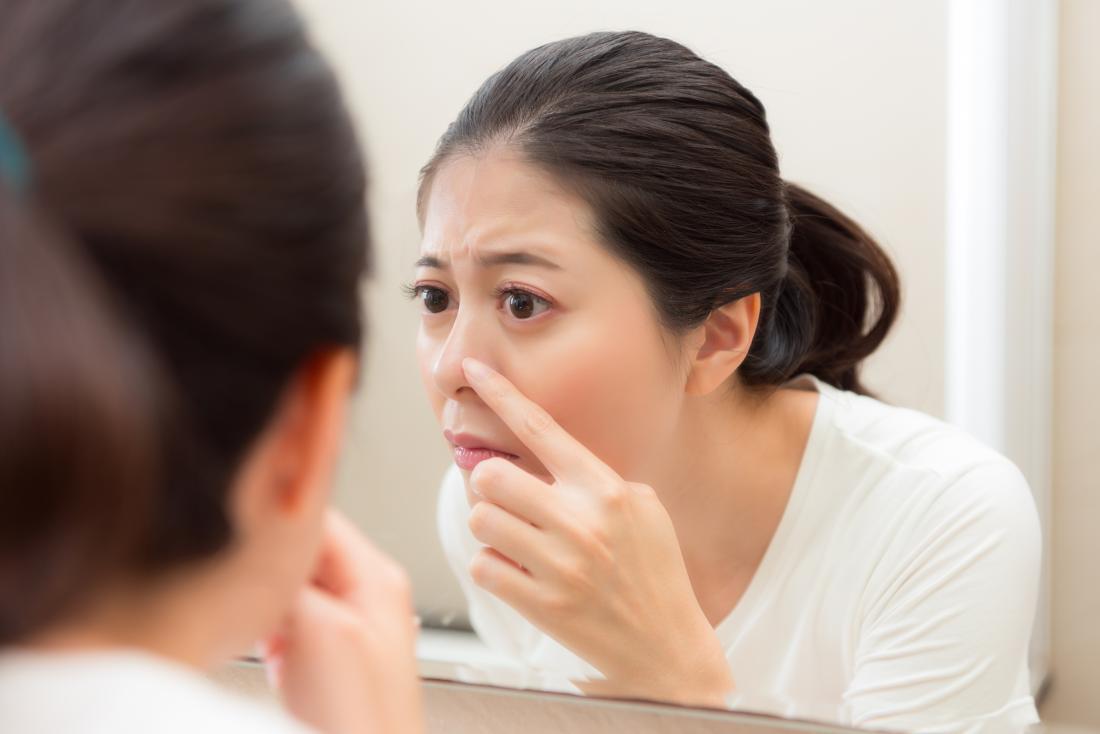 الرؤوس البيضا على الانف: اسبابها, طرق علاجها, الوقاية منها