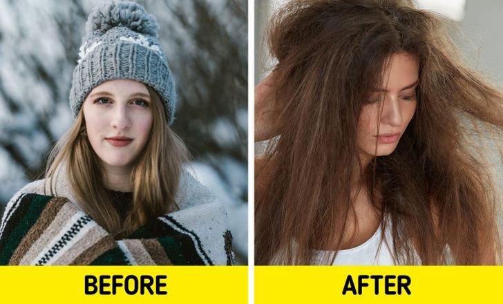 تأثير الجو البارد على الشعر 1