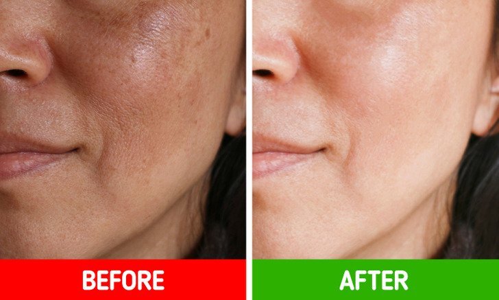 طرق طبيعية لبشرة صحية 6