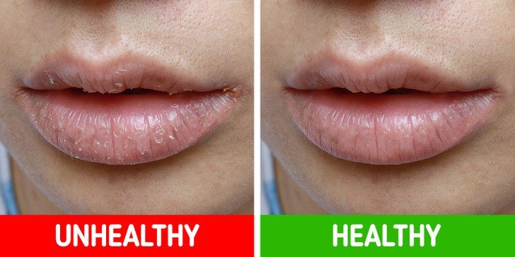 علامات تحذيرية من جسمك 3