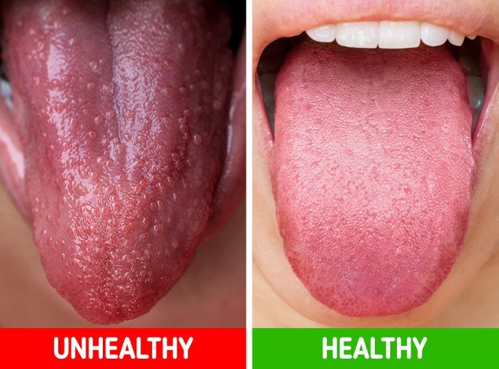 علامات تحذيرية من جسمك 8