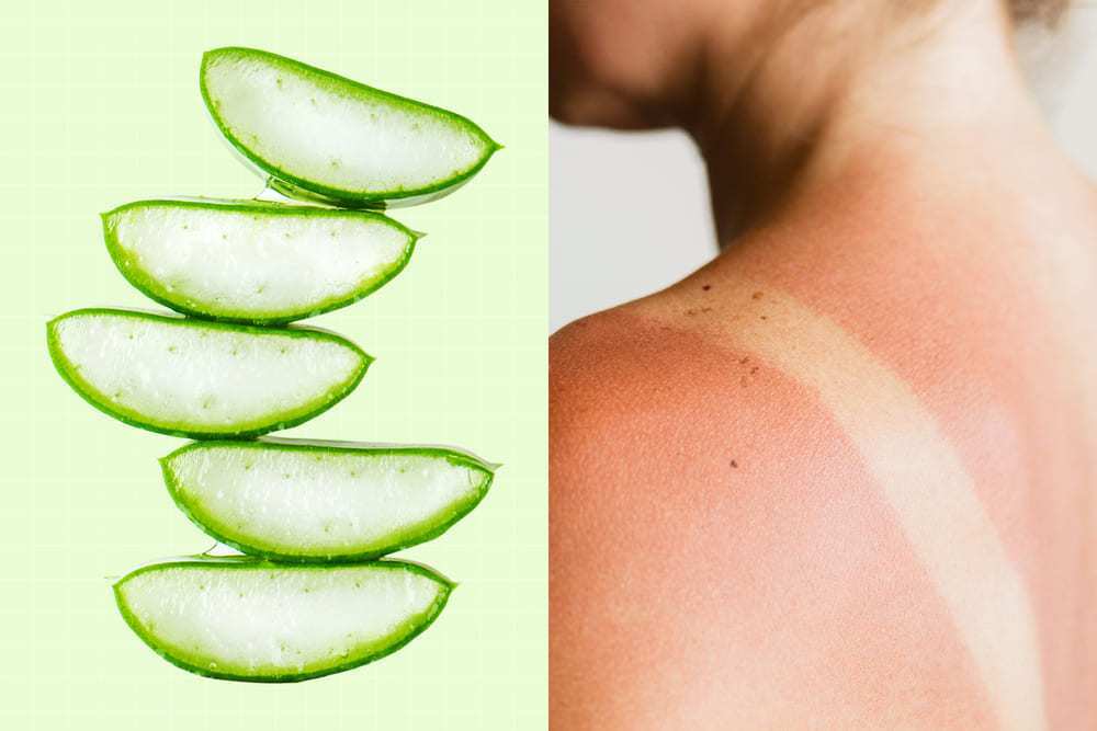 طرق التخلص من تقشير حروق الشمس 3