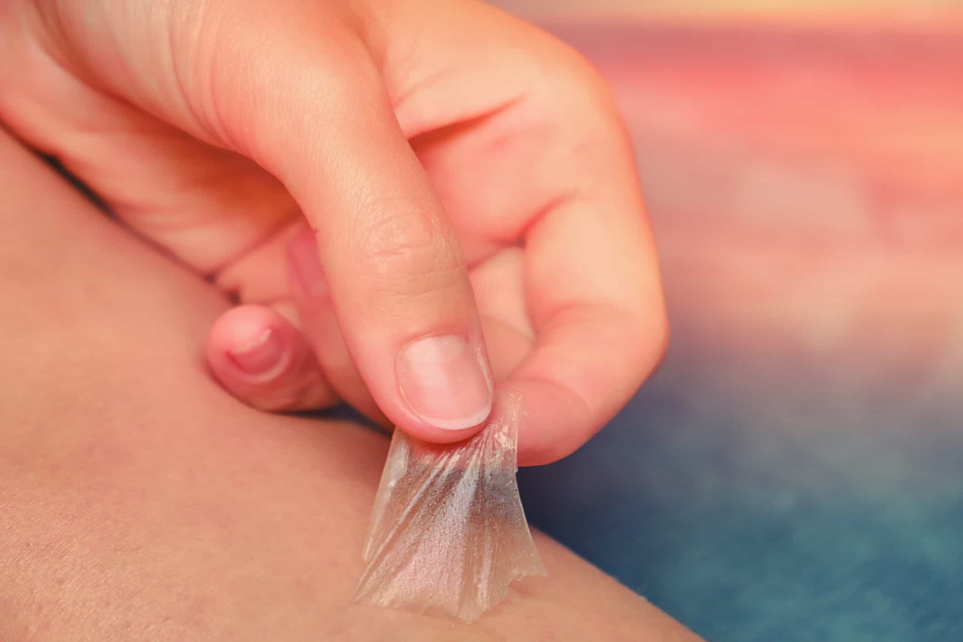 طرق التخلص من تقشير حروق الشمس 6