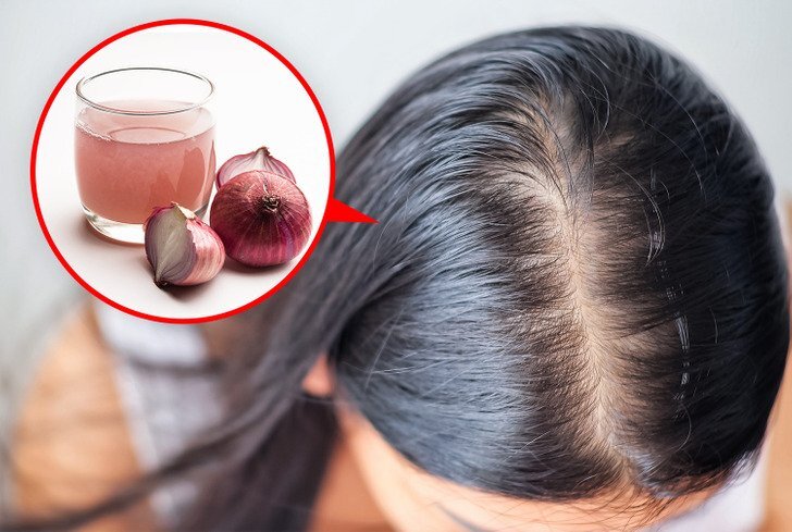 علاجات طبيعية لمنع تساقط الشعر 2