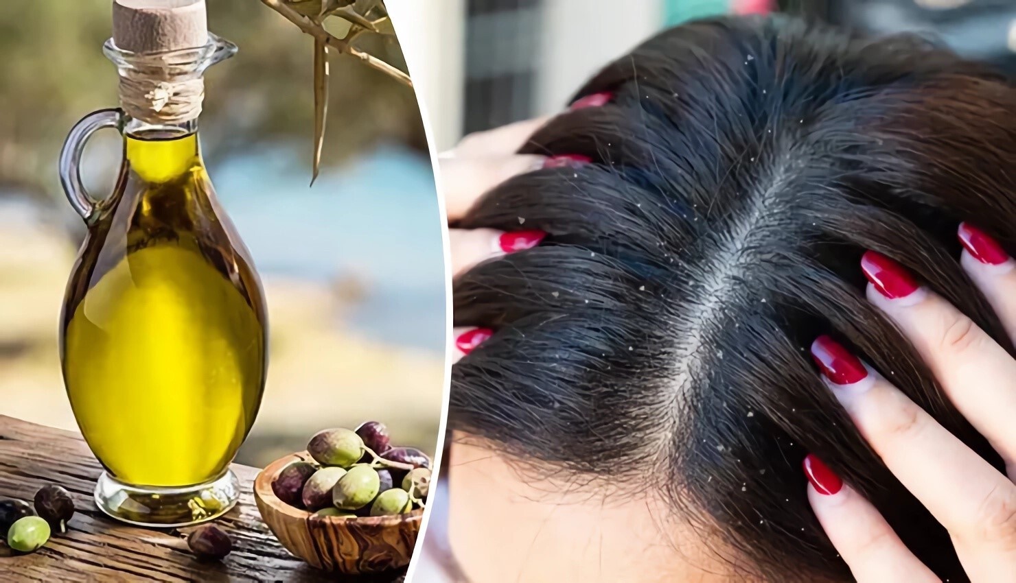 7 طرق طبيعية فعالة باستخدام زيت الزيتون لعلاج قشرة الراس