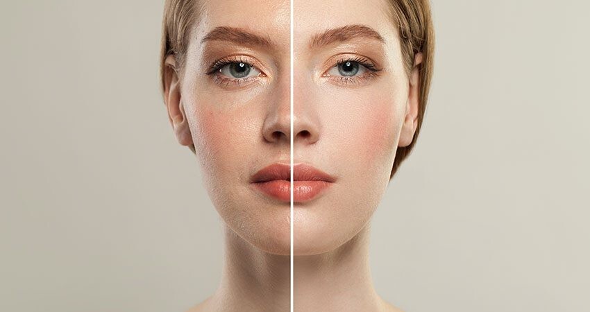 Skin Boosters 2