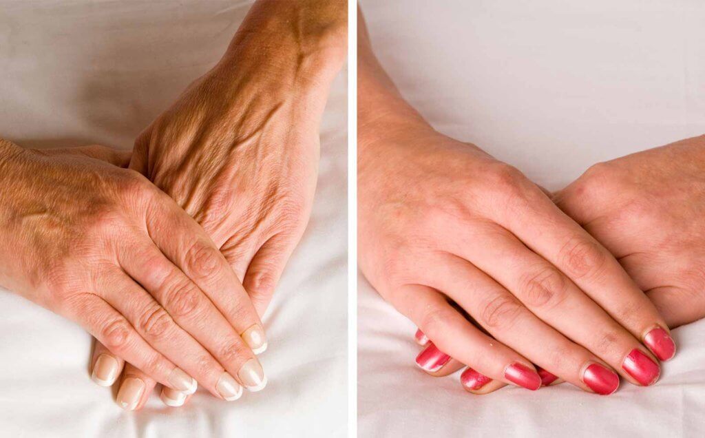 skin boosters 8