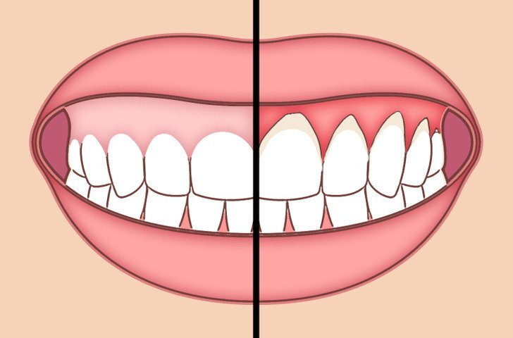 عادات يومين للحفاظ على صحة الفم 1