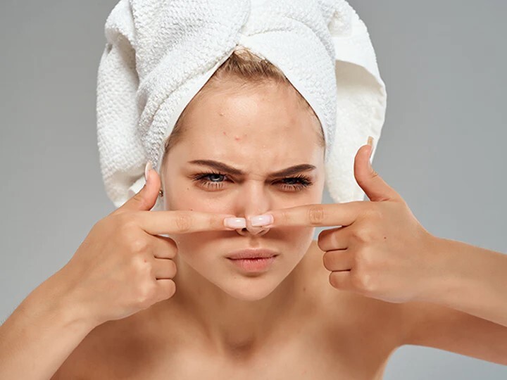 اسباب ظهور حب الشباب 4