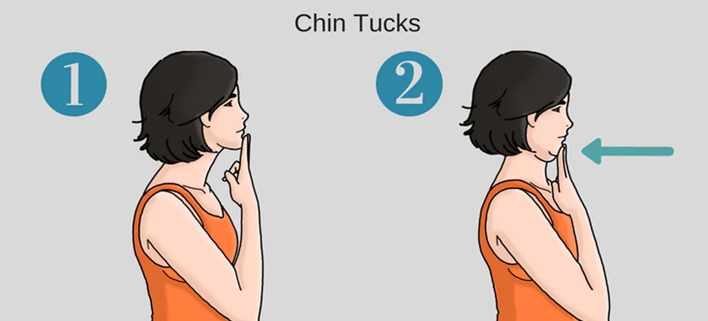 تمرين Chin tucks تمرين Chin tucks