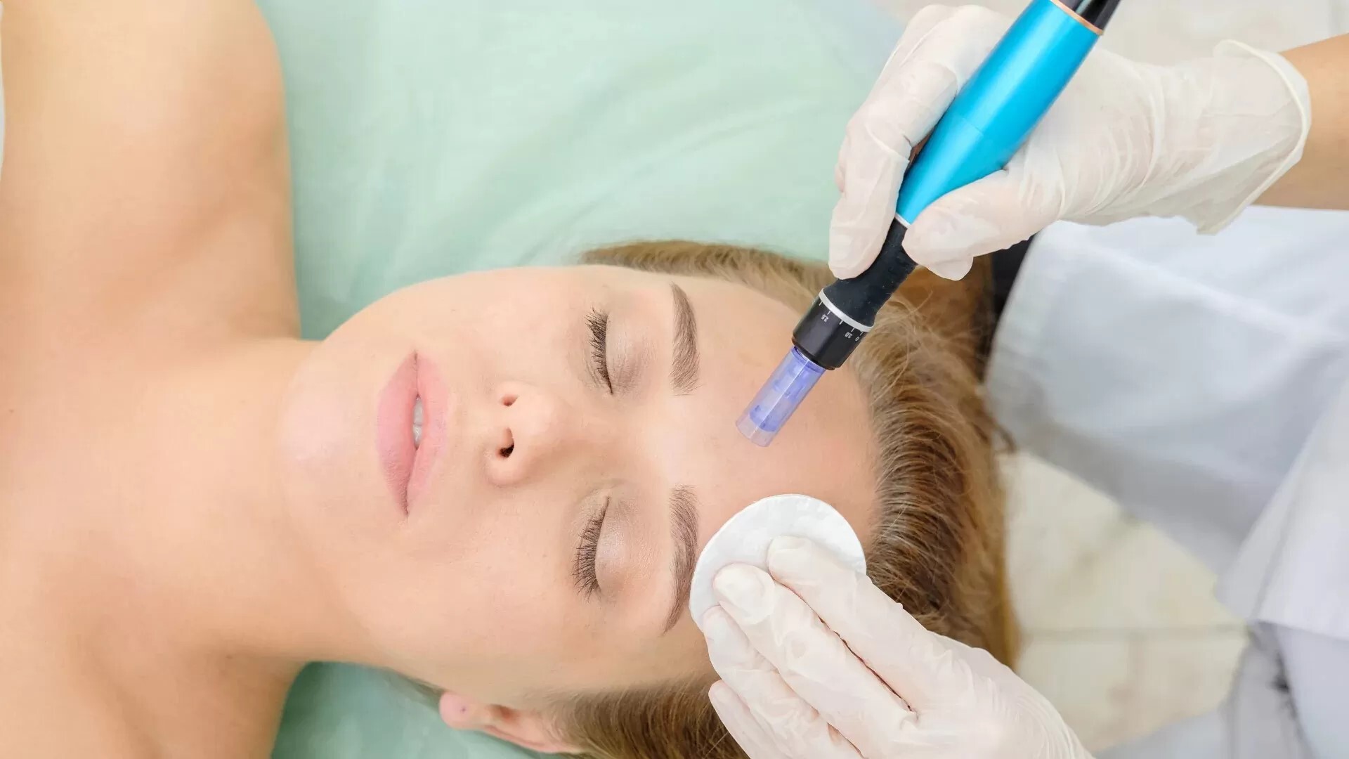 7 حاجات لازم تعرفيها قبل ما تعملي ميكرونيدلينج Microneedling لبشرتك