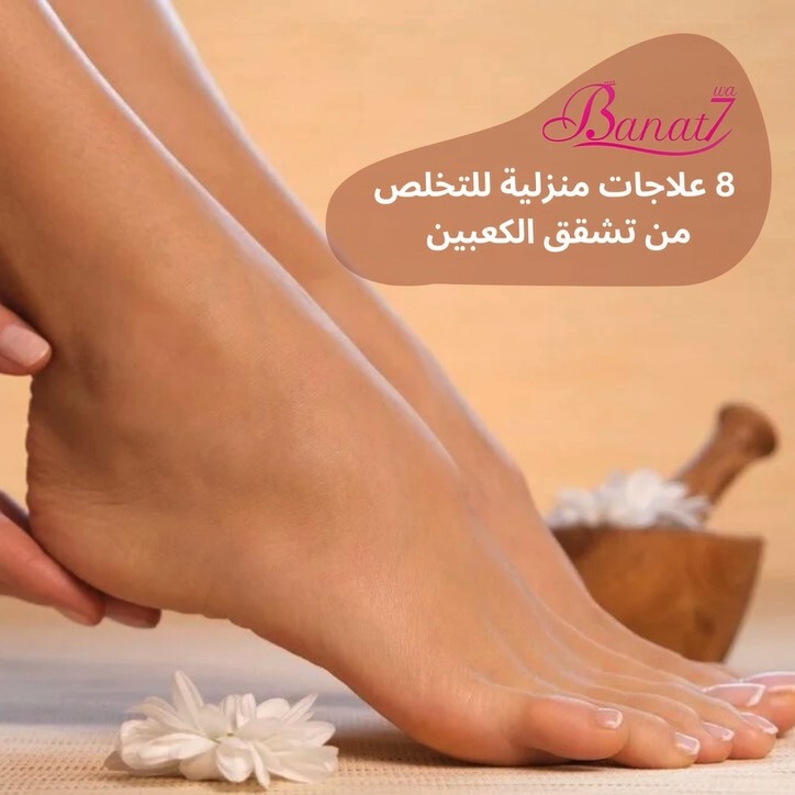 8 علاجات منزلية للتخلص من تشقق الكعبين