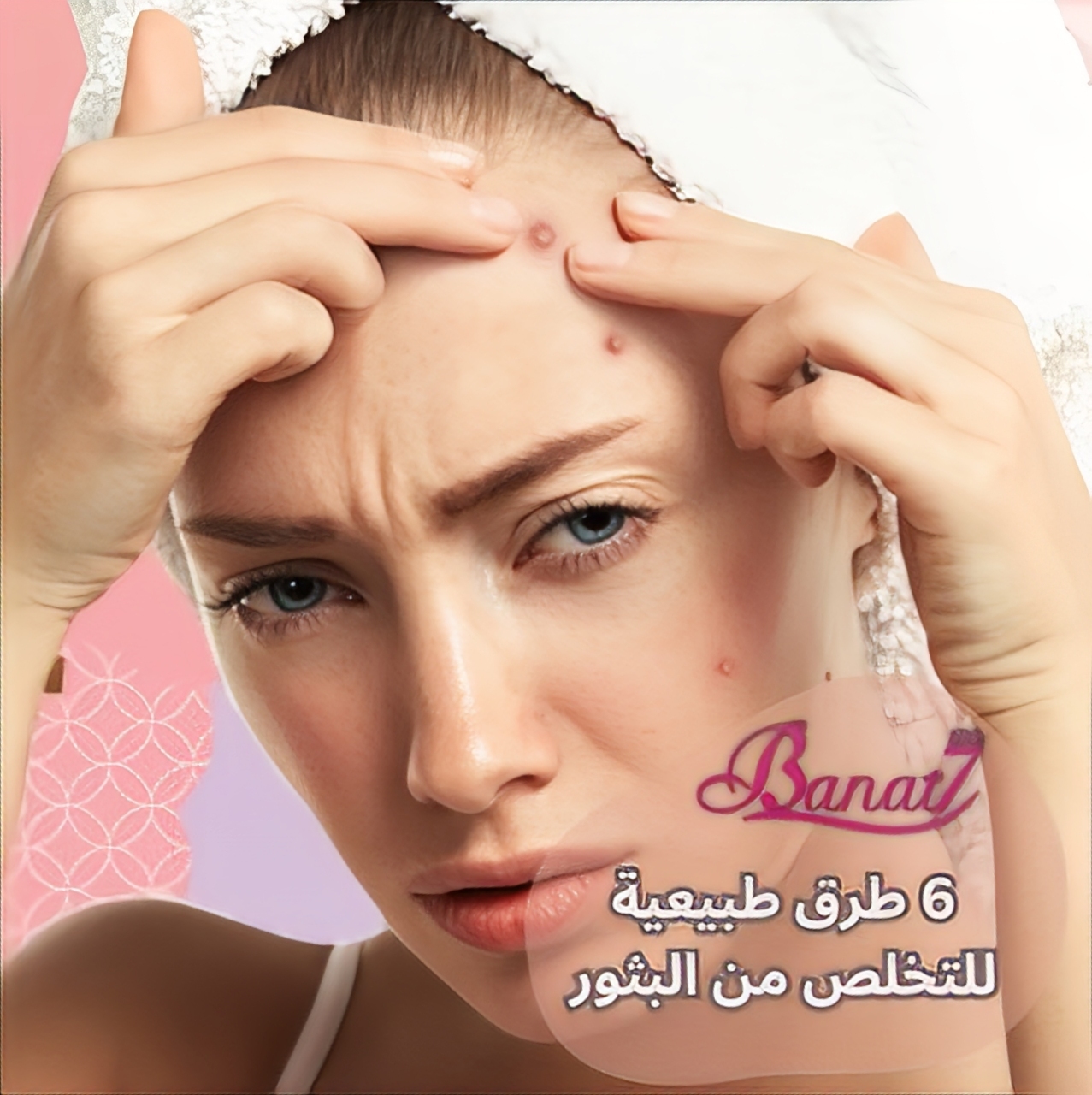 6 طرق طبيعية للتخلص من البثور وحب الشباب