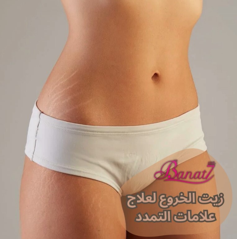 زيت الخروع لعلاج علامات التمدد