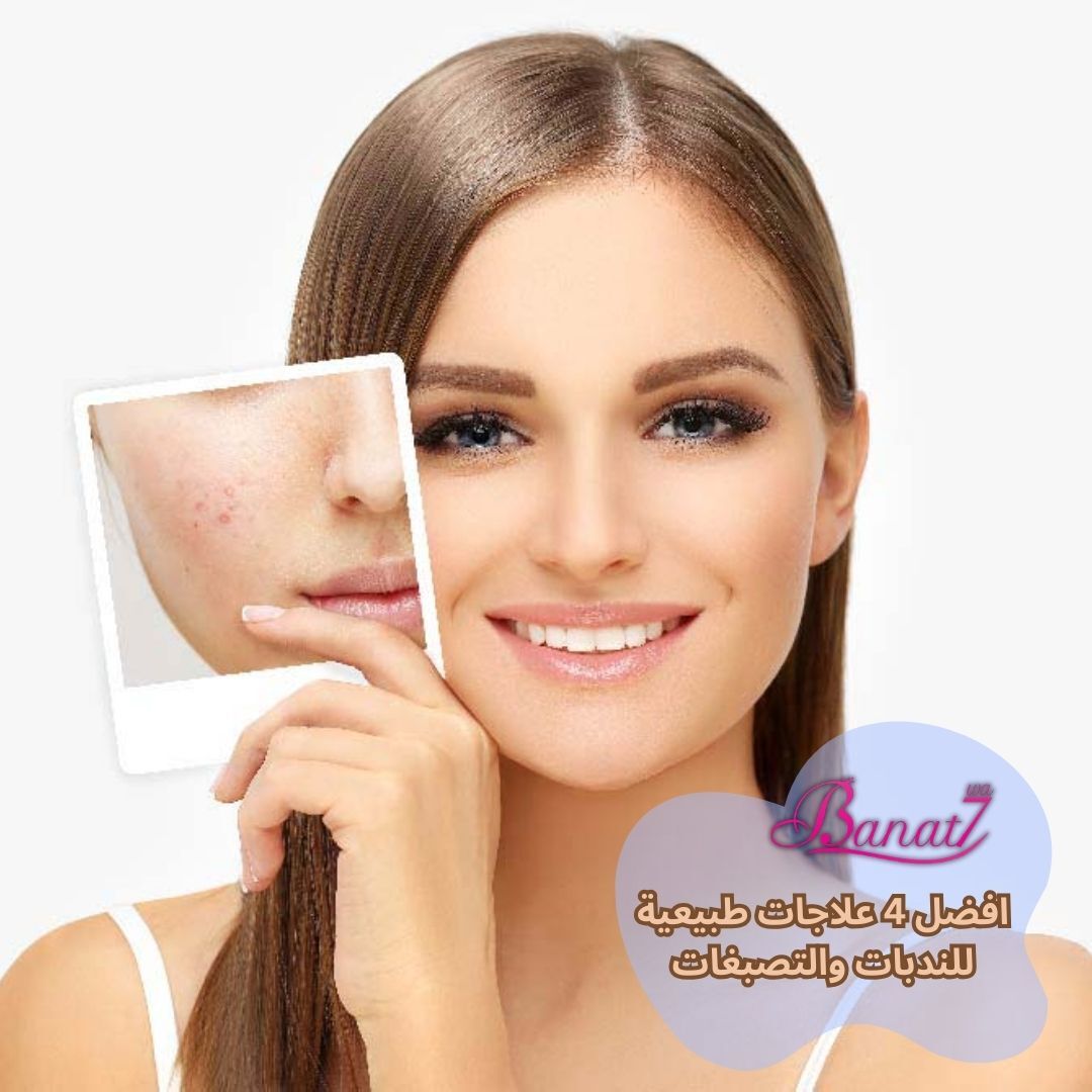 افضل 4 علاجات طبيعية للندبات والتصبغات